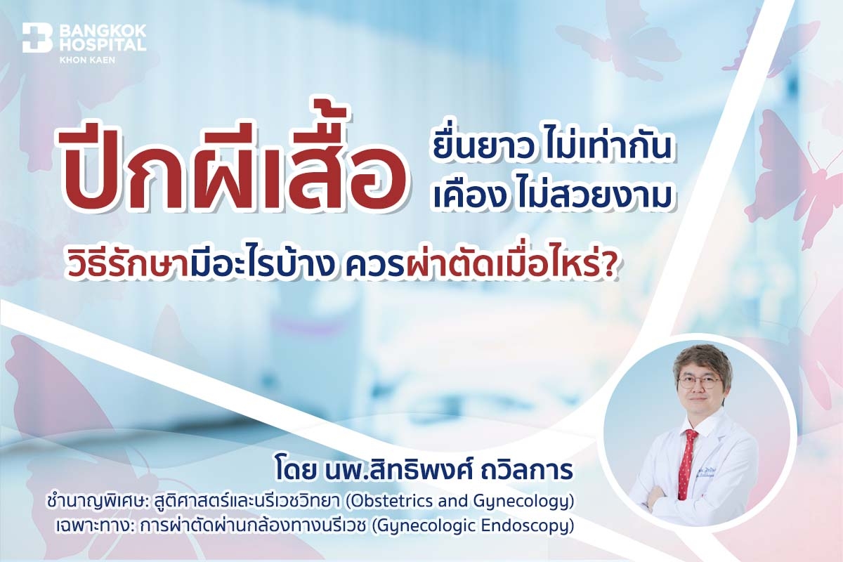 ปีกผีเสื้อ