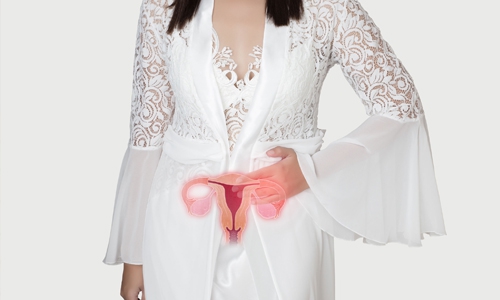What Women Should Know about Endometriosis